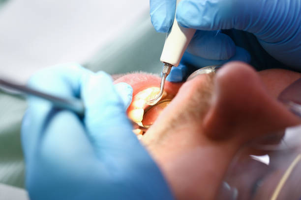 Best Walk-In Emergency Dental Services in Franklin Lakes, NJ